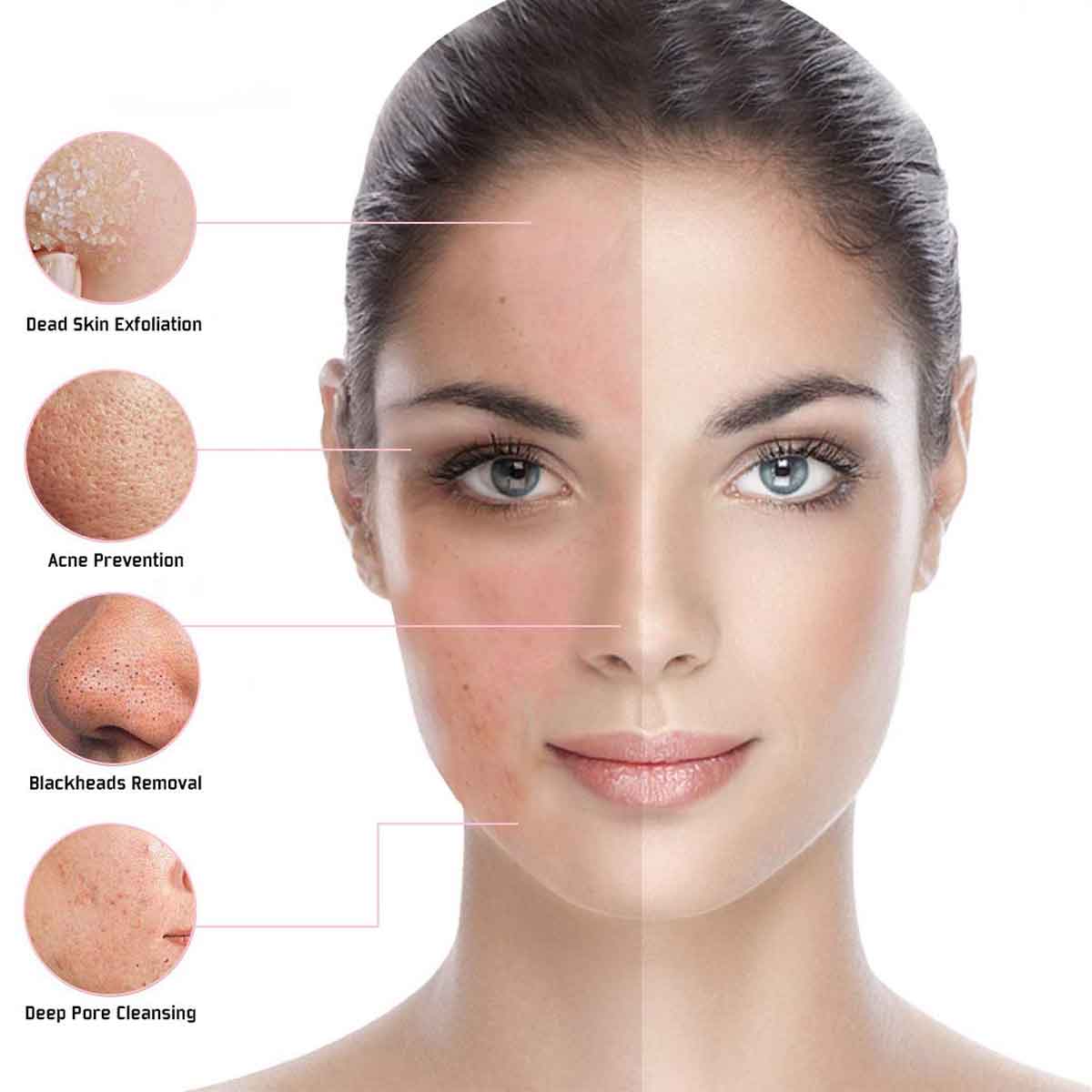RF Facial Photon LED Skin Care Beauty Device